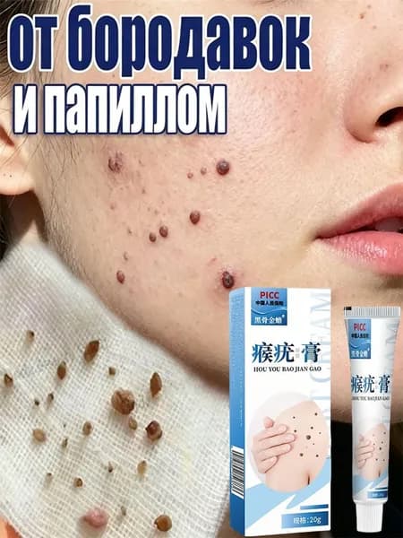MR&MISS карандаш от папиллом и бородавок 3 мл, папиллом и родинок без боли и следов. Без побочных эффектов