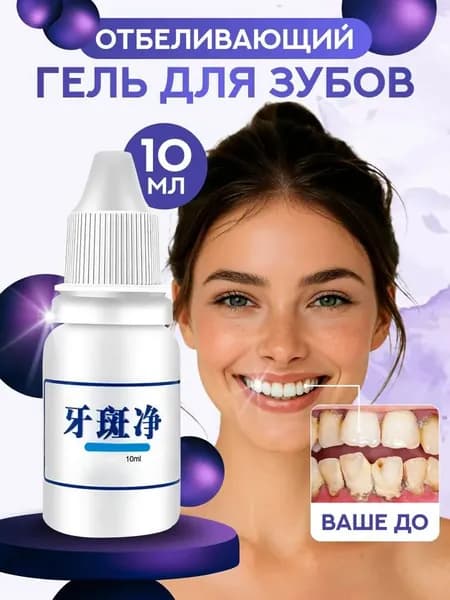 Гель для отбеливания зубов, профессиональный уход в домашних условиях, косметический уход за белизной