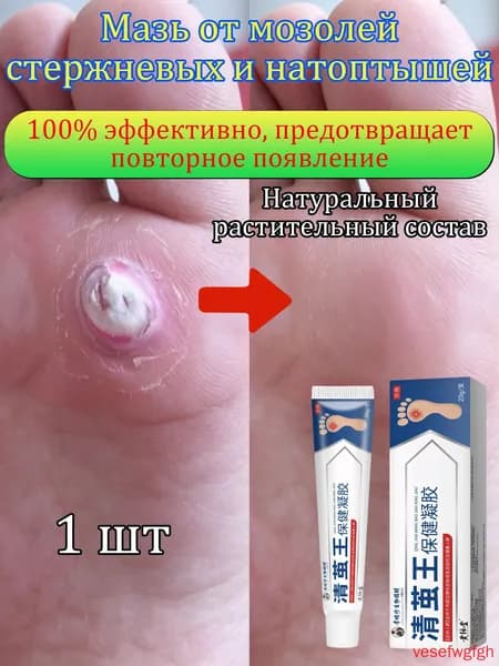 Mазь от мозолей стержневых и натоптышей ,Крем от сухих мозолей, шипицы, бородавок, натоптышей,20 г 1 шт.(1)