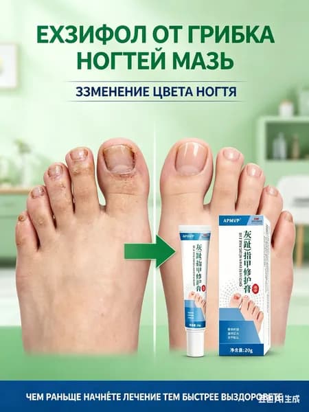 Противогрибковая мазь для лечения грибковых инфекций ногтей на ногах и гиперкератоза противогрибковые препараты для ног