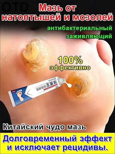 Mазь от мозолей стержневых и натоптышей ,Крем от сухих мозолей, шипицы, бородавок, натоптышей,20 г.