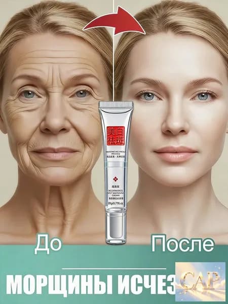ARAVIA Крем для антивозрастной, ретидерм крем для лица антивозрастной. с гиалуроновой кислотой, витамин с и мочевиной, устраняет темные круги, от отеков и мешков под глазами, Средство против морщин