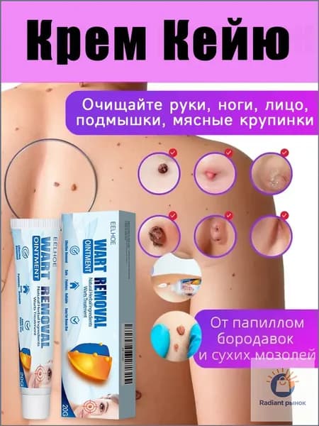 Средство от папиллом и бородавок, мазь для ухода за кожей, крем от родинок, Натуральные растительные ингредиенты 20г