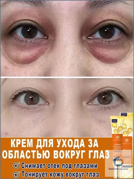 DODOYURI крем для век антивозрастной для кожи вокруг от темных кругов и морщин 20 мл