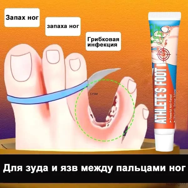 Эффективный крем от запаха ног зуда и язв между пальцами против грибка дезодорирующий 20г