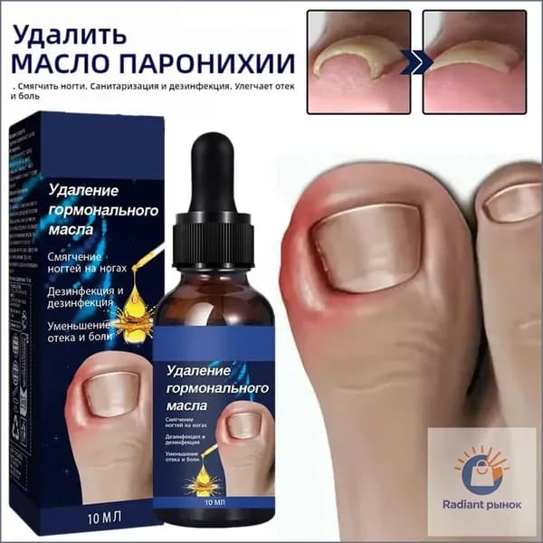 Качественный препарат от вросших ногтей, масло для терапии паронихии, 20 г
