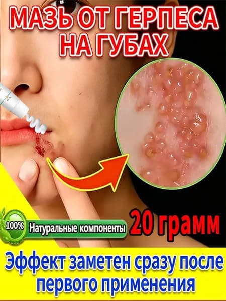 Противовирусная увлажняющая помада от герпеса, воспаления уголков рта, зуда, покраснения и волдырей 20г