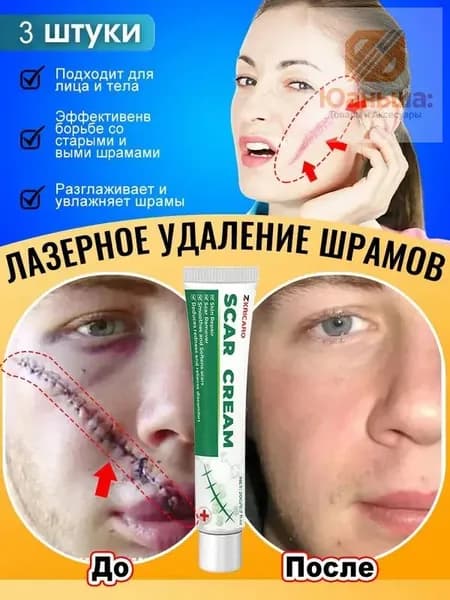 Крем от шрамов и рубцов, гель от прыщей на лице, мазь против ожогов и пигментных пятен и теле, средство от постакне30 г