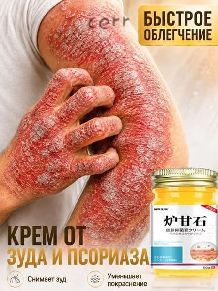 Негормональная мазь от псориаза, экземы, нейродермита и грибковых заболеваний, китайский крем от псориаза, 50 г.