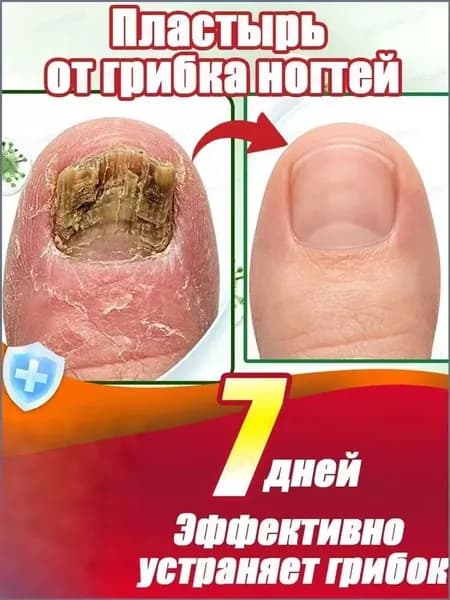 от грибка ногтей на ногах, лечение и восстановление ногтей, уменьшает желтизну, утолщение, зуд и боль, быстрое и эффективное действие, уход за ногтями, 1 шт.