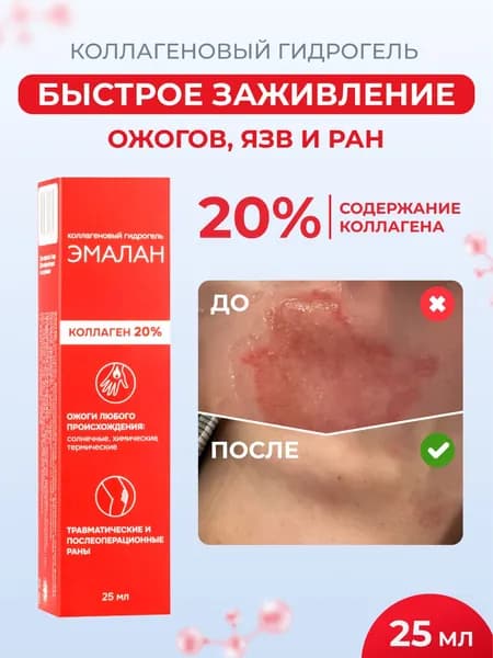 Эмалан Гидрогель коллагеновый, заживляющий, от ожогов и ран, ранозаживление, 25 мл