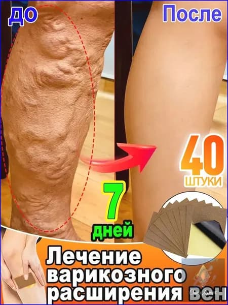 Пластыри премиум от варикоза, патчи для ног от отеков, 40 штук