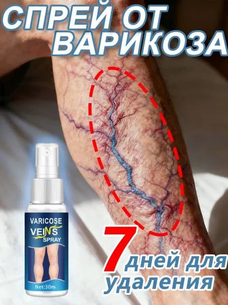 Средство от варикоза с натуральными растительными экстрактами, улучшает циркуляцию крови и снижает отечность ног, 30 мл