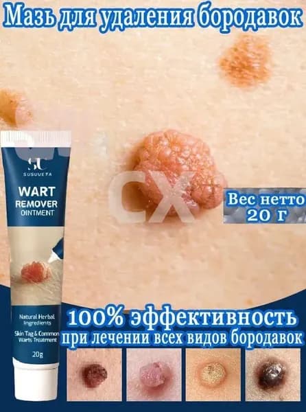 крем от бородавок и папиллом, средство для удаления сухих мозолей и натоптышей, уход за кожей рук и ног, 20 г