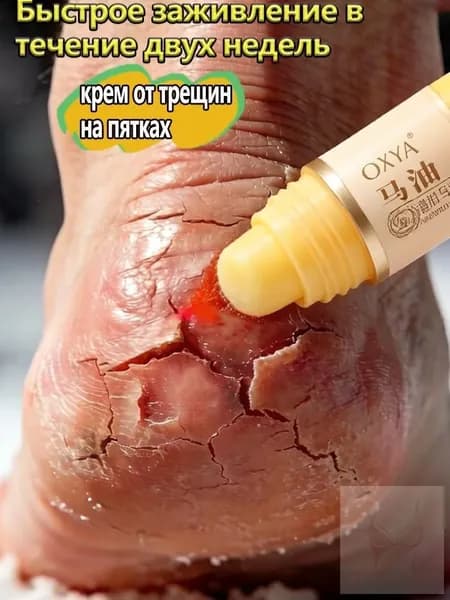 Крем воск для ног с мочевиной 5 , от трещин на пятках, увлажняющий