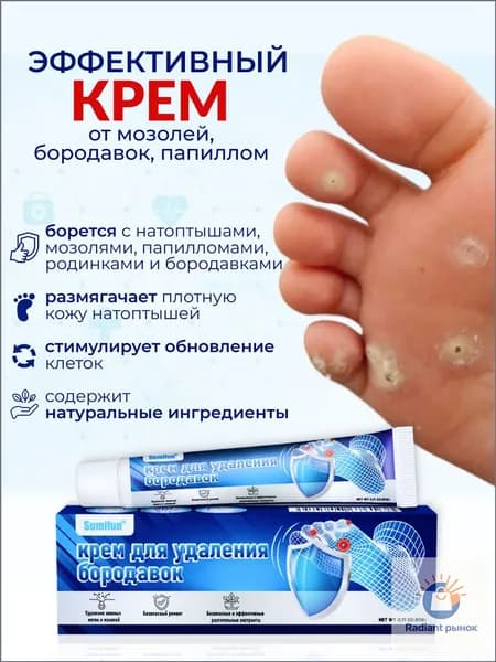 Средство от мозолей и натоптышей на ногах / Мазь от бородавок и папиллом на руках и лице
