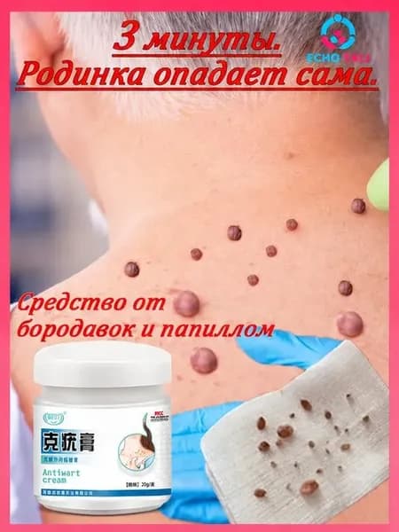 Мазь от папиллом и бородавок, средство для удаления шипиц, наростов, кожных образований 20 г