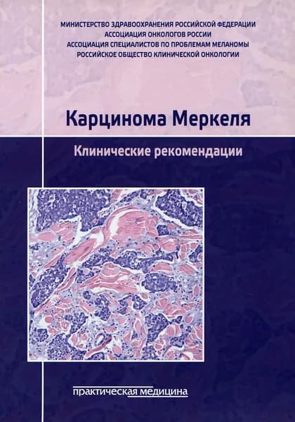 Карцинома Меркеля. Клинические рекомендации | Буланов Анатолий Анатольевич