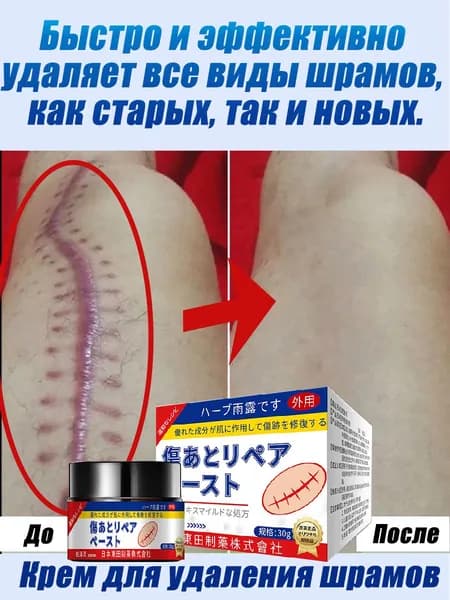 Крем для удаления шрамов/Удаление рубцов,натуральные ингредиенты,Для лица и тела/30 г