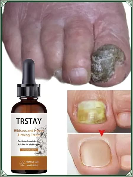 Укрепляющая сыворотка TRSTAY для ногтей рук и ног с гибискусом, медом и гиалуроном, увлажняет кутикулу, разглаживает ногтевую пластину, мягкая формула для любой кожи