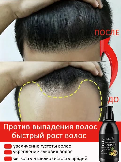 Шампунь против выпадения волос для роста волос