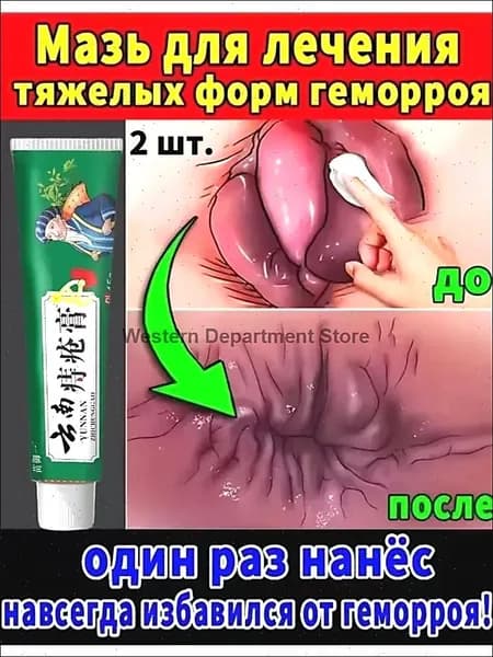 Чудодейственный восстанавливающий крем для устранения геморроя и опухолей, способствующий заживлению анальных трещин и устранению зуда;/2 шт.