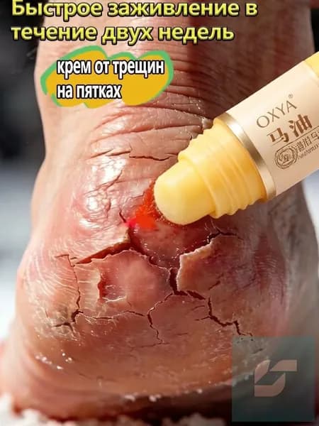 Крем воск для ног с мочевиной 5 , от трещин на пятках, увлажняющий