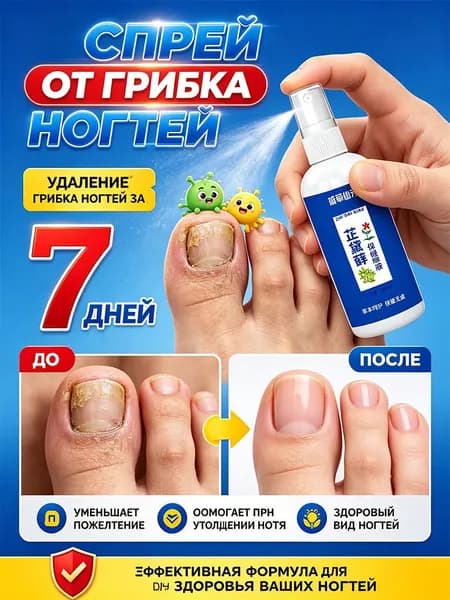 Спрей для быстрого удаления грибка ногтей, 100 мл.