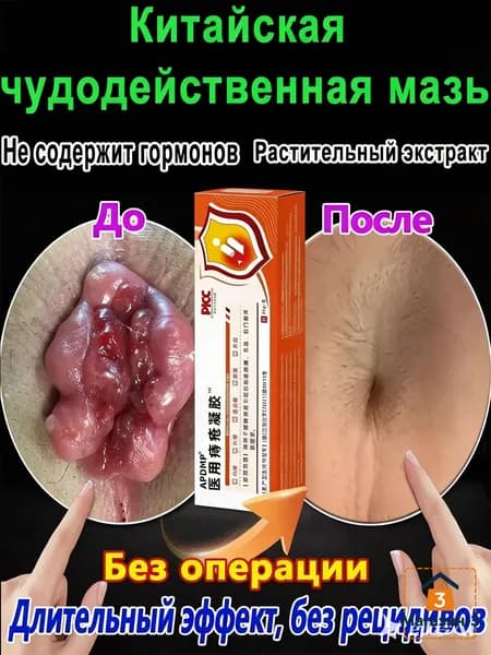 Китайская чудо мазь от геморроя, 100% натуральная, лечит геморрой и анальные трещины, снимает боль, уменьшает отек и дискомфорт, как для мужчин, так и для женщин, 20 г.