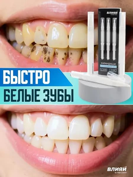 Карандаш для отбеливания зубов