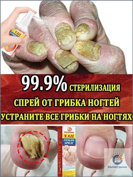 Спрей, используемый для лечения грибка ногтей.Быстро удалите все грибки с ногтей на ногах в течение 7 дней. Он подходит для восстановления и стимулирования роста.30 мл