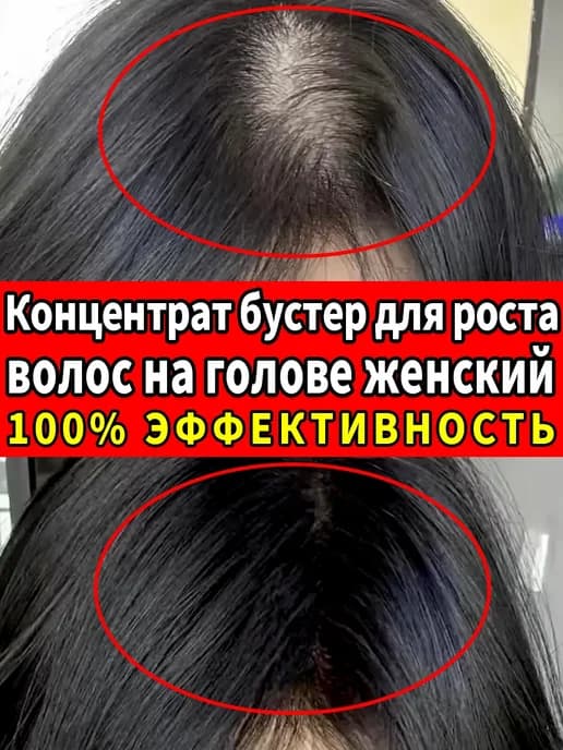 Концентрат бустер для роста волос на голове женский