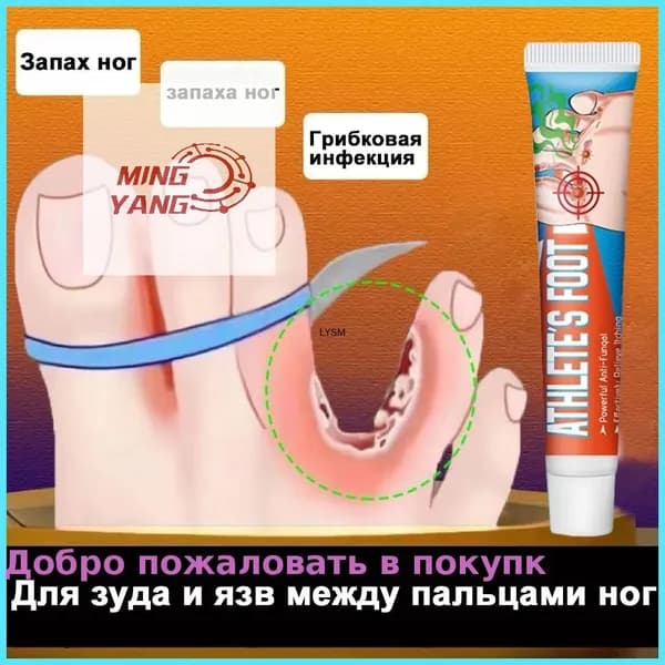 Средство от запаха ног для зуда и язв между пальцами, против грибка, дезодорант эффективное 20г