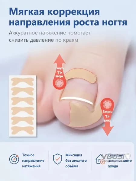 Наклейки от вросшего ногтя,20 шт