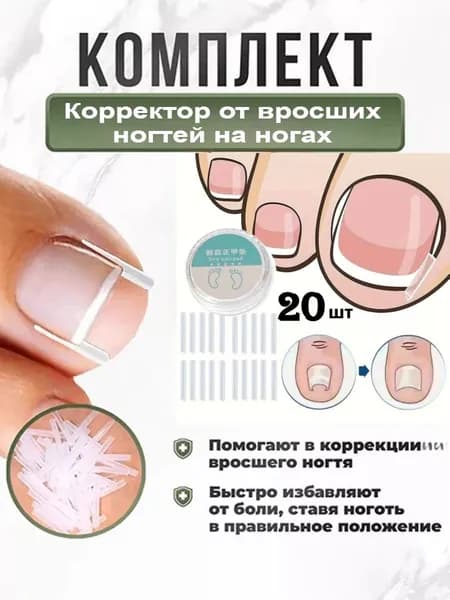Корректор От Вросших Ногтей На Ногах