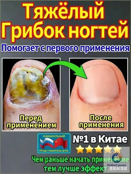 мазь ноготок от грибка ногтей на ногах,Лечите грибковые инфекции, укрепляйте и восстанавливайте ногти и роговой слой кожи, а также устраняйте грибок ногтей на ногах.