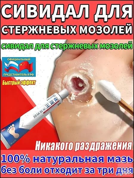Эксклюзивный китайский гель и мазь Корнекс для устранения шипиц, натоптышей и стержневых мозолей на стопах