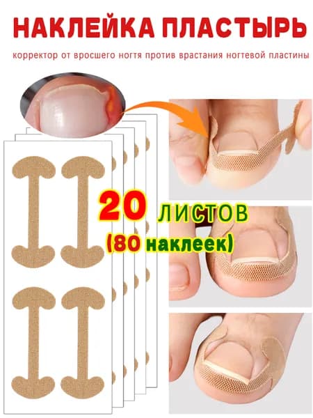 Наклейка пластырь,корректор от вросшего ногтя против врастания ногтевой пластины,20 листов (80 наклеек)
