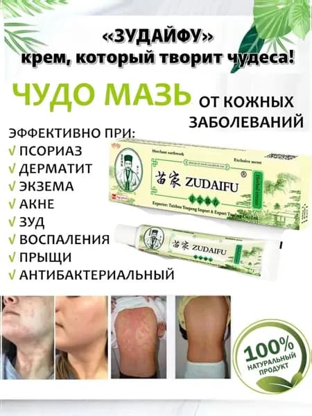 Крем мазь от псориаза для лица и тела zudaifu Зудайфу