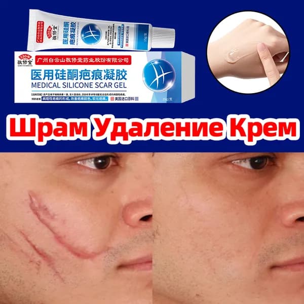 китайский Силиконовый Гель от шрамов, крем от шрамов и рубцов, крем от рубцов,растяжек, ожогов/ 15 г