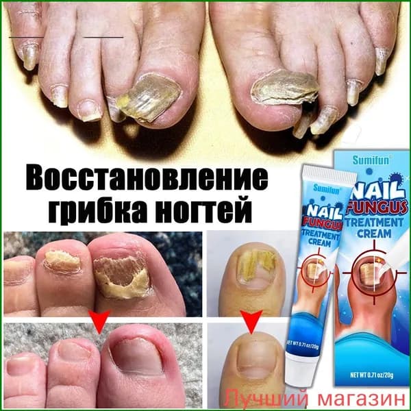 Премиум уход для ногтей, кутикулы