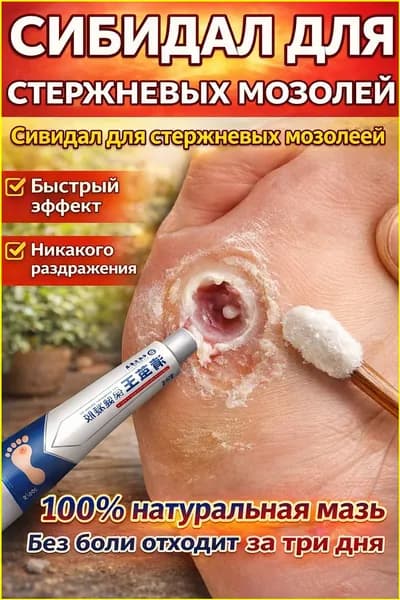 Средство от шипиц, натоптышей и сухих стержневых мозолей на ногах мазь и гель Корнекс,эффективное китайское средство