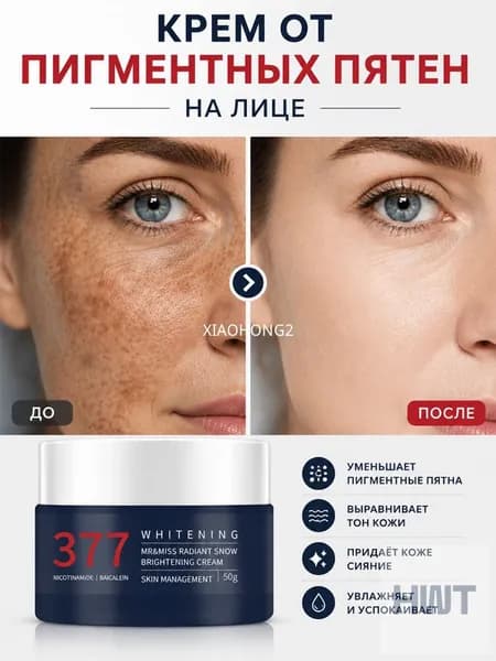 Отбеливающий крем для лица,Эффективно удаляет веснушки,пигментные пятна,солнечные ожоги и возрастные пятна,7DAYS осветляет и выравнивает тон,30 г