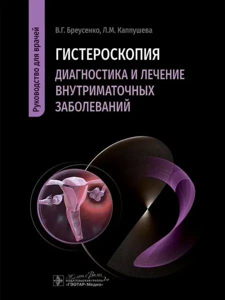 Гистероскопия Диагностика и лечение внутриматочных заболеван
