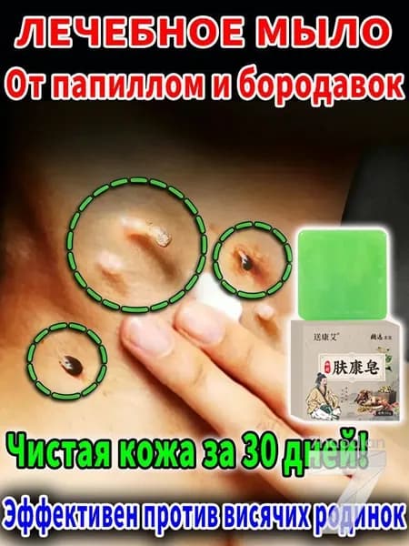 Лечебное травяное мыло от папиллом на лице и шее