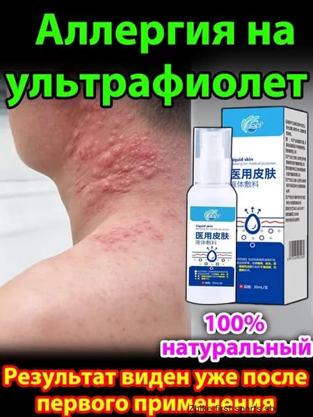 Крем для лечения солнечного дерматита,Восстановление кожи после солнечных ожогов крем после загара