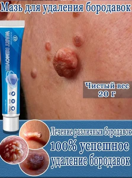 DODOYURI Крем от бородавок и папиллом, средство для удаления бородавок, крем для проблемной кожи, 20 г