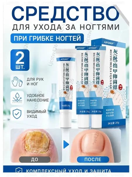2 штуки,крем ноготок от грибка ногтей на ногах,ноготок мазь от грибка на ногах,гиперкератоз