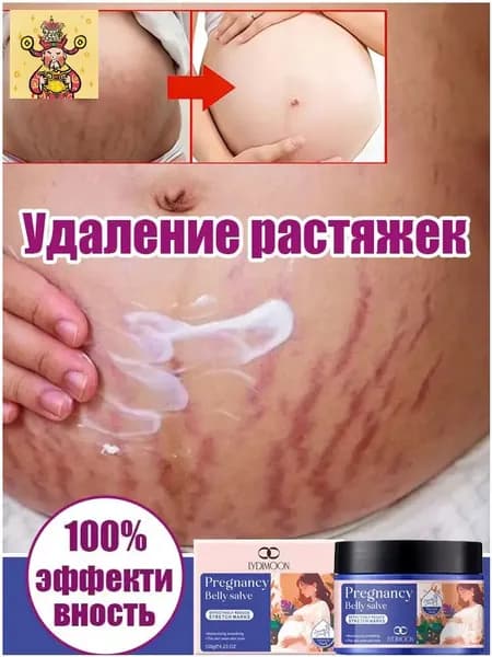 Крем от растяжек для беременных, Быстрое удаление растяжек, пигментации и шрамов,Послеродовые абдоминальные линии,восстанавливает эластичность кожи, подходит для ухода за кожей после родов 120 г.