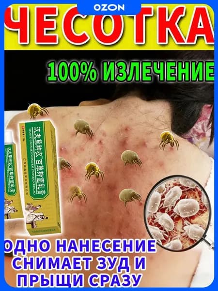 Мазь от чесотки и демодекоза (клещей) на спине